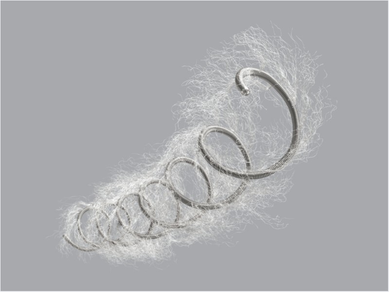 Mola de embolização Nester®